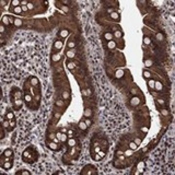 Anti-CDCA7L antibody produced in rabbit Prestige Antibodies&#174; Powered by Atlas Antibodies, affinity isolated antibody, buffered aqueous glycerol solution