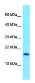 Anti-UBE2V1 (C-terminal) antibody produced in rabbit affinity isolated antibody