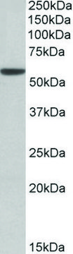 Anti-ALDH3A1 (C-terminal) antibody produced in goat affinity isolated antibody, buffered aqueous solution