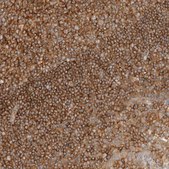 Anti-RABEP1 antibody produced in rabbit Prestige Antibodies® Powered by Atlas Antibodies, affinity isolated antibody, buffered aqueous glycerol solution, Ab2