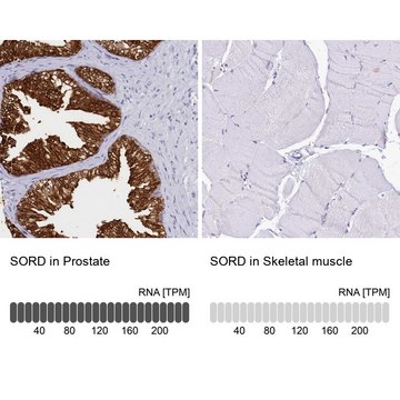 Anti-SORD antibody produced in rabbit Prestige Antibodies&#174; Powered by Atlas Antibodies, affinity isolated antibody, buffered aqueous glycerol solution