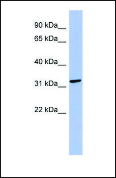 Anti-MAGEB2, (N-terminal) antibody produced in rabbit affinity isolated antibody