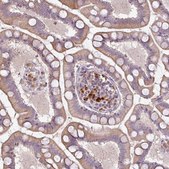 Anti-CXCR5 antibody produced in rabbit Prestige Antibodies® Powered by Atlas Antibodies, affinity isolated antibody, buffered aqueous glycerol solution