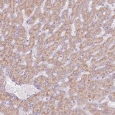 Anti-SYS1 antibody produced in rabbit Prestige Antibodies® Powered by Atlas Antibodies, affinity isolated antibody, buffered aqueous glycerol solution