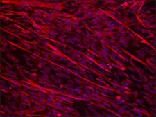 Anti-Dysferlin (N-terminal region) antibody produced in rabbit ~1.5 mg/mL, affinity isolated antibody