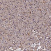 Anti-KATNB1 antibody produced in rabbit Prestige Antibodies® Powered by Atlas Antibodies, affinity isolated antibody, buffered aqueous glycerol solution