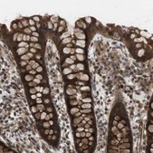 Anti-CTPS2 antibody produced in rabbit Prestige Antibodies® Powered by Atlas Antibodies, affinity isolated antibody, buffered aqueous glycerol solution