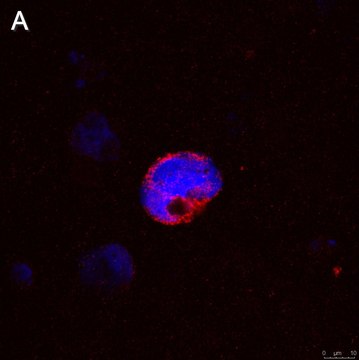 Anti-IFN&#947; Antibody, clone 5K15 ZooMAb&#174; Rabbit Monoclonal recombinant, expressed in HEK 293 cells