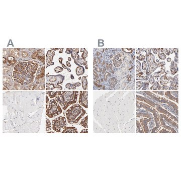 Anti-CD2AP antibody produced in rabbit Ab2, Prestige Antibodies&#174; Powered by Atlas Antibodies, affinity isolated antibody, buffered aqueous glycerol solution