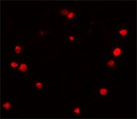 Anti-PIBF1 antibody produced in rabbit affinity isolated antibody