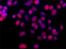 Anti-Proliferating Cell Nuclear Antigen antibody, Mouse monoclonal clone PC 10, purified from hybridoma cell culture
