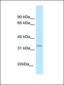 Anti-KHK antibody produced in rabbit affinity isolated antibody