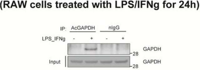 Anti-acetyl-GAPDH (Lys160) Antibody 0.5&#160;mg/mL, from rabbit