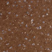 Anti-ANK2 antibody produced in rabbit Prestige Antibodies® Powered by Atlas Antibodies, affinity isolated antibody, buffered aqueous glycerol solution