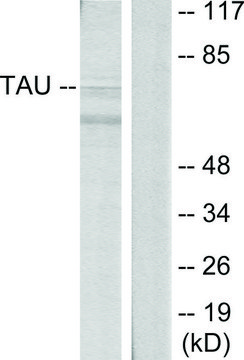 Anti-TAU antibody produced in rabbit affinity isolated antibody