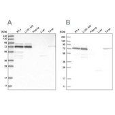 Anti-PPM1G antibody produced in rabbit Prestige Antibodies® Powered by Atlas Antibodies, affinity isolated antibody, buffered aqueous glycerol solution