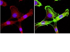 Anti-Erythropoietin Antibody, clone 1C8 clone 1C8, Chemicon®, from mouse