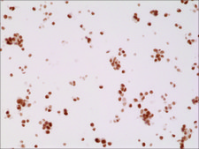 Anti-AR (n-terminal) antibody, Rabbit monoclonal recombinant, expressed in HEK 293 cells, clone RM254, purified immunoglobulin