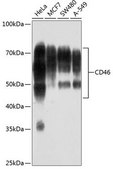 Anti-CD46 antibody produced in rabbit