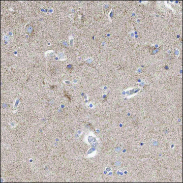 Anti-RSPO2 antibody produced in rabbit Prestige Antibodies&#174; Powered by Atlas Antibodies, affinity isolated antibody, buffered aqueous glycerol solution