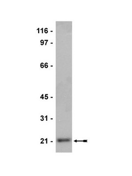 Anti-Sar1 Antibody Upstate&#174;, from rabbit