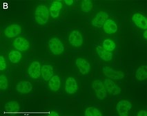 Anti-p-IκBα-Ser32 Antibody, clone 11D19 ZooMAb® Rabbit Monoclonal recombinant, expressed in HEK 293 cells