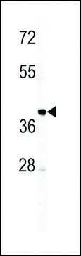 ANTI-IGHM(N-TERMINAL) antibody produced in rabbit purified immunoglobulin, buffered aqueous solution