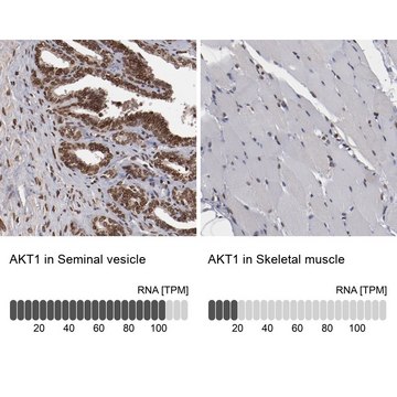 Anti-AKT1 antibody produced in rabbit Prestige Antibodies&#174; Powered by Atlas Antibodies, affinity isolated antibody, buffered aqueous glycerol solution