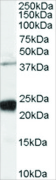 Anti-GIPC1/NIP antibody produced in goat affinity isolated antibody, buffered aqueous solution