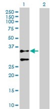 Anti-ACTG2 antibody produced in rabbit purified immunoglobulin, buffered aqueous solution