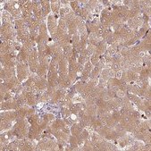 Anti-SH2D6 antibody produced in rabbit Prestige Antibodies® Powered by Atlas Antibodies, affinity isolated antibody, buffered aqueous glycerol solution