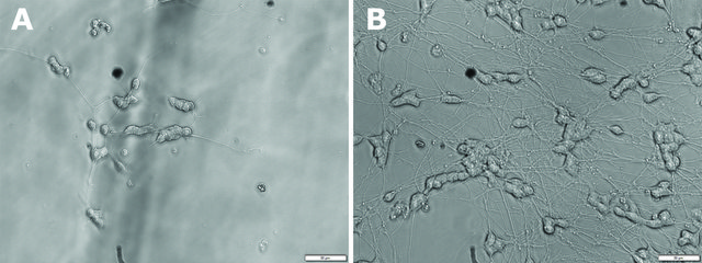 脑源性神经营养因子 人 BDNF, recombinant, expressed in E. coli, lyophilized powder, suitable for cell culture