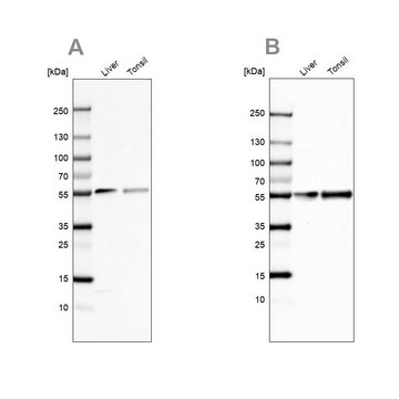 Anti-GC antibody produced in rabbit Prestige Antibodies&#174; Powered by Atlas Antibodies, affinity isolated antibody, buffered aqueous glycerol solution