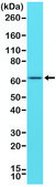 Anti-ER alpha antibody, Rabbit Monoclonal recombinant, expressed in HEK 293 cells, clone RM292, purified immunoglobulin