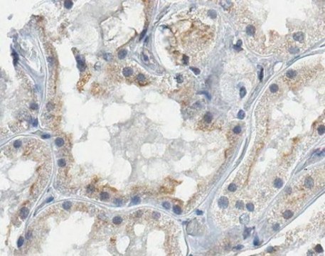 Anti-MATE2/SLC47A2 Antibody from rabbit, purified by affinity chromatography