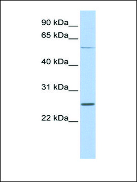 Anti-SCN1B affinity isolated antibody