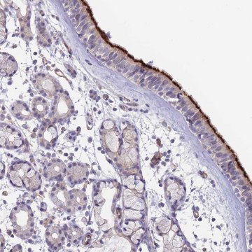 Anti-NDUFAF5 antibody produced in rabbit Prestige Antibodies&#174; Powered by Atlas Antibodies, affinity isolated antibody, buffered aqueous glycerol solution