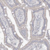 Anti-MTHFD2L antibody produced in rabbit Prestige Antibodies® Powered by Atlas Antibodies, affinity isolated antibody, buffered aqueous glycerol solution