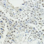 Anti-Phospho-Histone H3-T45 antibody produced in rabbit