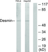 Anti-Desmin antibody produced in rabbit affinity isolated antibody