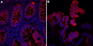 Anti-PEPCK from rabbit, purified by affinity chromatography
