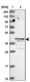 Anti-ALKBH1 antibody produced in rabbit Prestige Antibodies® Powered by Atlas Antibodies, affinity isolated antibody, buffered aqueous glycerol solution