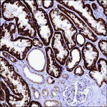 抗-IGF1R 兔抗 Prestige Antibodies&#174; Powered by Atlas Antibodies, affinity isolated antibody, buffered aqueous glycerol solution