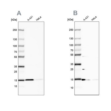 Anti-CCDC58 antibody produced in rabbit Prestige Antibodies&#174; Powered by Atlas Antibodies, affinity isolated antibody, buffered aqueous glycerol solution