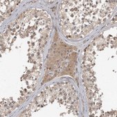 Anti-MINDY1 antibody produced in rabbit Prestige Antibodies® Powered by Atlas Antibodies, affinity isolated antibody, buffered aqueous glycerol solution, ab1