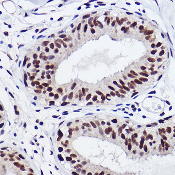 Anti-GTF2I Antibody, clone 5B6D1, Rabbit Monoclonal