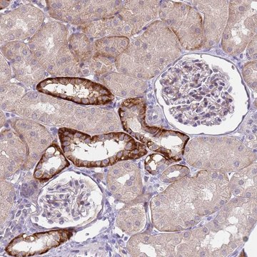 Anti-TRMT10A antibody produced in rabbit Prestige Antibodies&#174; Powered by Atlas Antibodies, affinity isolated antibody, buffered aqueous glycerol solution