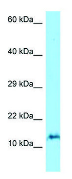 Anti-ORMDL3 (N-terminal) antibody produced in rabbit affinity isolated antibody