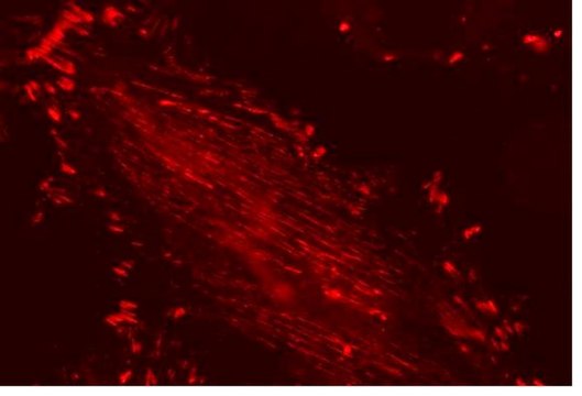 LentiBrite Paxillin-RFP Lentiviral Biosensor