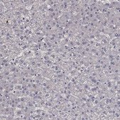 Anti-MPP2 antibody produced in rabbit Prestige Antibodies® Powered by Atlas Antibodies, affinity isolated antibody, buffered aqueous glycerol solution